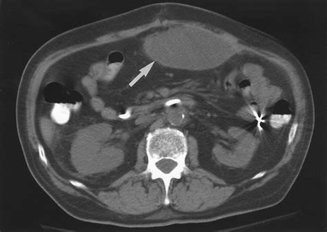 surgical sponges scanning